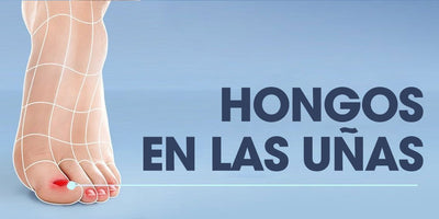 Hongos en las uñas: síntomas, causas y tratamiento