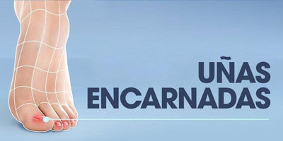 Cómo tratar una uña encarnada